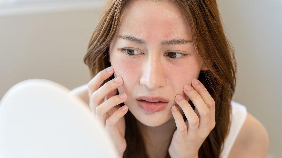 Kvinna med känslig och röd hud som kontrollerar huden efter microneedlingbehandling i spegel.
