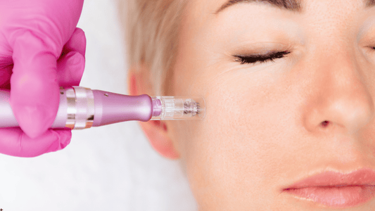 Microneedling under ögonen med dermapen utförd av hudterapeut, närbild som visar behandling av känsligt ögonområde och illustrerar om microneedling under ögonen är säkert och effektivt